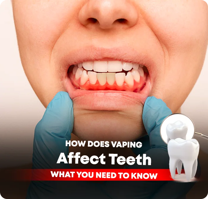 How Does Vaping Affect Teeth? What You Need to Know