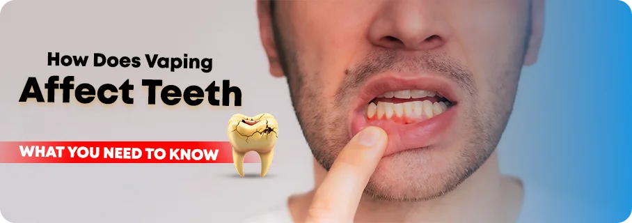 How_Does_Vaping_Affect_Teeth_What_You_Need_to_Know_banner